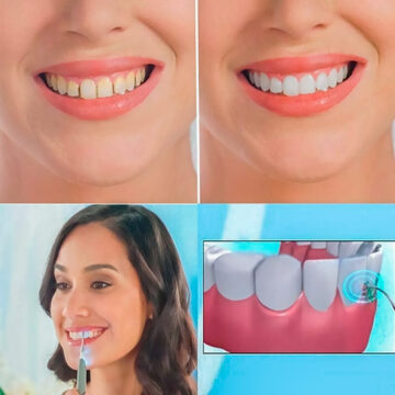Alternative view of Limpiador Dental Raspador Ultrasónico Quita Sarro Portátil
