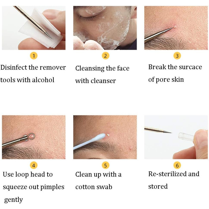 Pinzas Para Acne Y Espinillas 8 Piezas Cuidado De Piel - Imagen 2